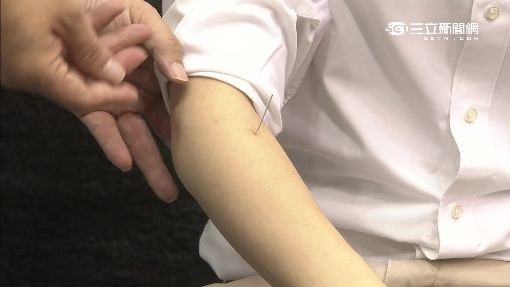 慕名求醫！男子被扎針「臉色發黑送醫」搶救不治　法醫一查「女醫內幕」嚇傻：太大膽了