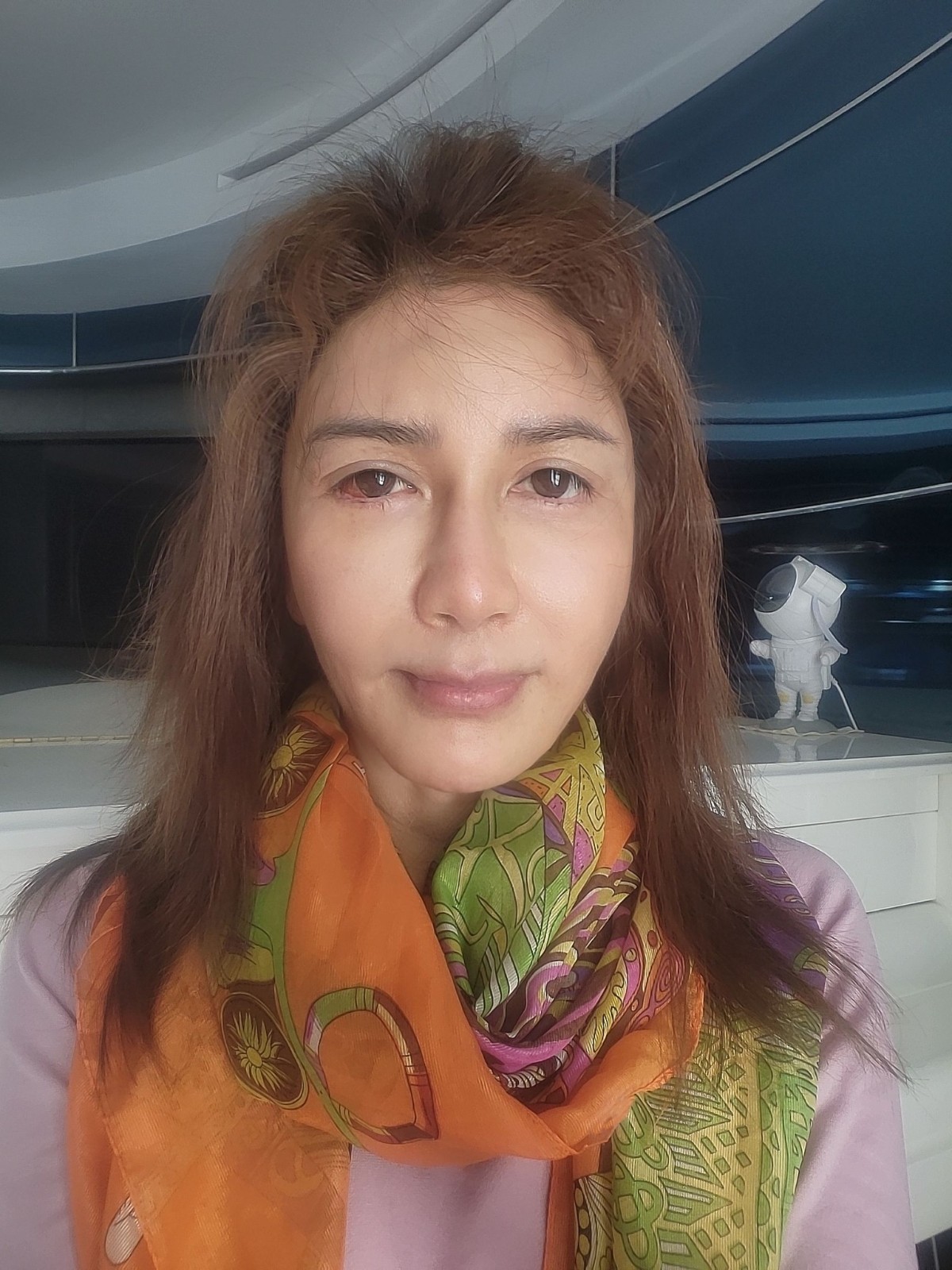 一年動刀2次！資深女星「崩潰曝病因」一度被誤診　苦嘆「被縫五針」嚇壞：震撼教育