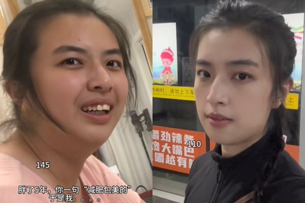 胖到只能買男裝！32歲女因朋友一句「妳瘦下來一定美」　半年鏟20kg「撞臉王祖賢」一夕爆紅